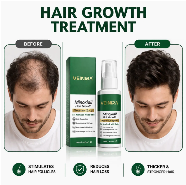 Minoxidil Hair Growth Anti Hair Lose Serum Spray Thickening Treatment Best Biotin Vitamins Hair Growth Product quality 1
