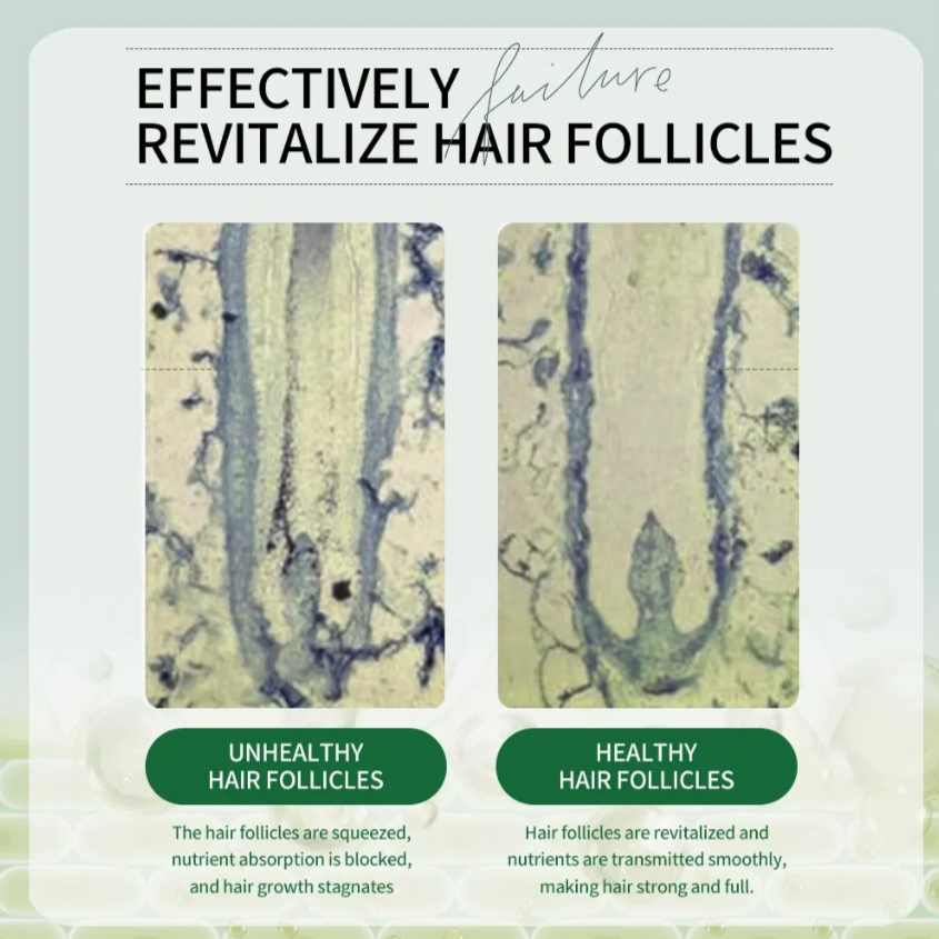 Cangty Private Label Natural Longer Fuller Hair Nourishes Smooth Split Ends Dry Scalp Miracle Hair Serum Oil Wholesale Organic OEM Batana Essential Oil quality 2