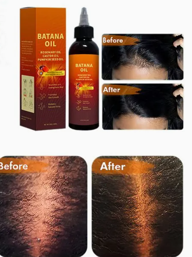 Cangty Private Label Hair Care Treatment Color Heat Protector Herbal Rosemary Hair Oil for Hair Growths quality 1